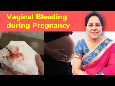 Bleeding During Pregnancy | Spotting in Pregnancy | Pregnancy Symptoms | iMumz