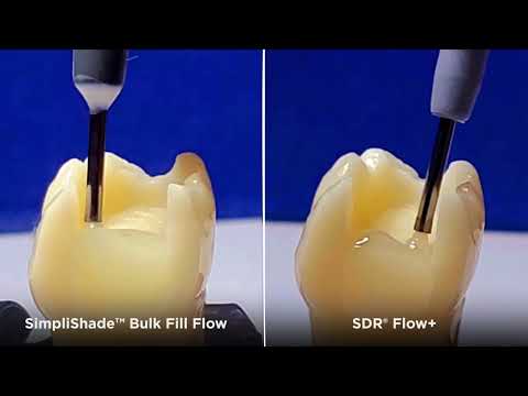 See the Difference: SimpliShade™ Bulk Fill Flow vs. SDR® flow+