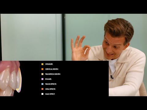 "How much will you shave off my teeth?" - PREP TALK