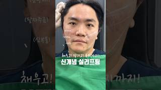 실 리프트 성형 시술