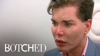 Dr. Paul Nassif Says Patient&#39;s Nose &quot;Could Fall Off&quot; | Botched | E!
