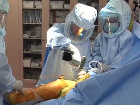 download lagu mp3 mp4 Hip Replacement Cost South Africa, download lagu Hip Replacement Cost South Africa gratis, unduh video klip Hip Replacement Cost South Africa