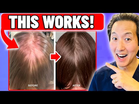 醫師大公開！今天就用這 5 個超有效方法，逆轉你的掉髮危機！ (5 Proven Ways To Reverse Hair Loss TODAY! Doctor Reveals)