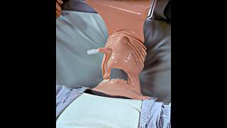 "Invisible Man" ☠️🔥 | Hollow Man | FUNK ABNORMAL (slowed) #Trending #Shorts