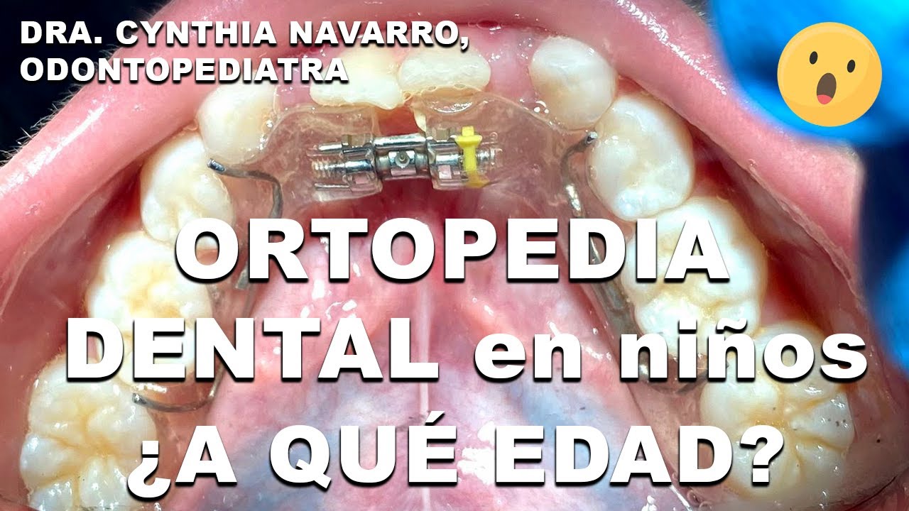 Tratamientos de ortopedia dental para niños | Conoce por qué son importantes.