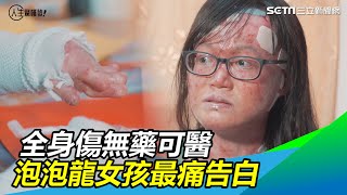 泡泡龍女孩全身傷「若可以，想比媽媽先走」