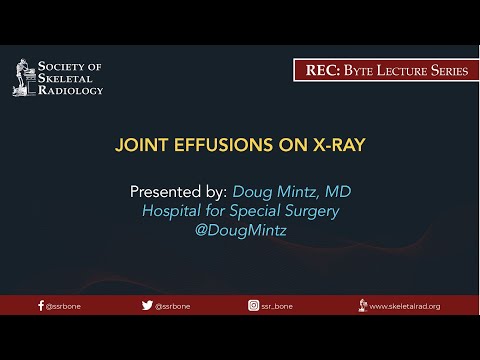 Joint Effusions on X-Ray
