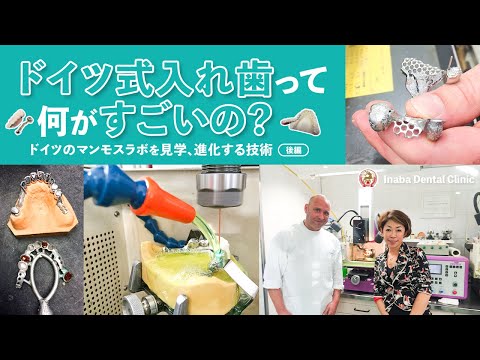 ドイツ式入れ歯って何がすごいの？〜ドイツのマンモスラボを見学、進化する技術〜＜後編＞