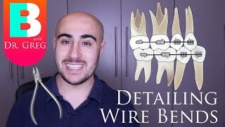 [BRACES EXPLAINED] Detailing Wire Bends