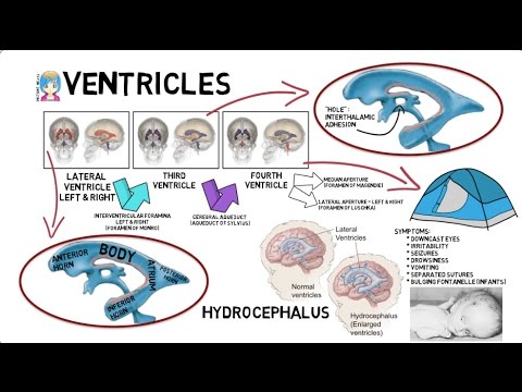 INSTANT NEURO - Ventricles