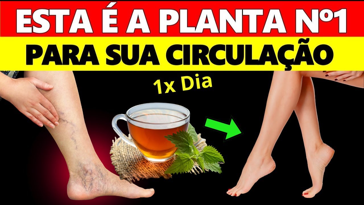 Elimine as Varizes e Melhore Sua Circulação Com Essas 10 Plantas Poderosas