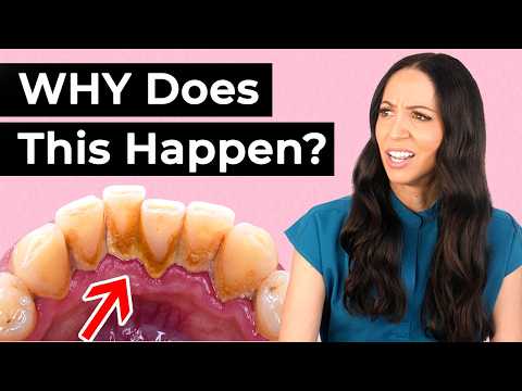 Why Does THIS Build Up On Your Teeth?