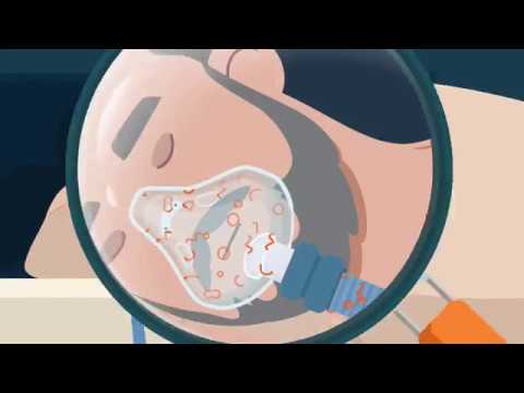Cleaning Your CPAP with SoClean 2