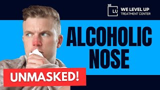 Alcoholic Nose Unmasked: The Ugly Reality of Excessive Drinking!