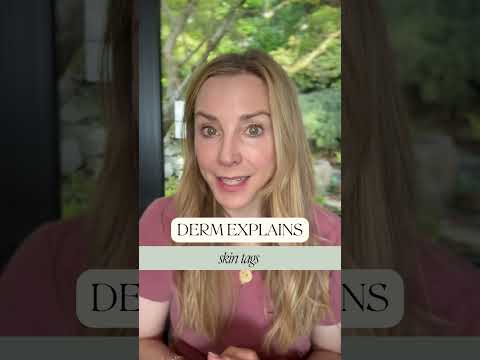 Derm Explains: Skin Tags