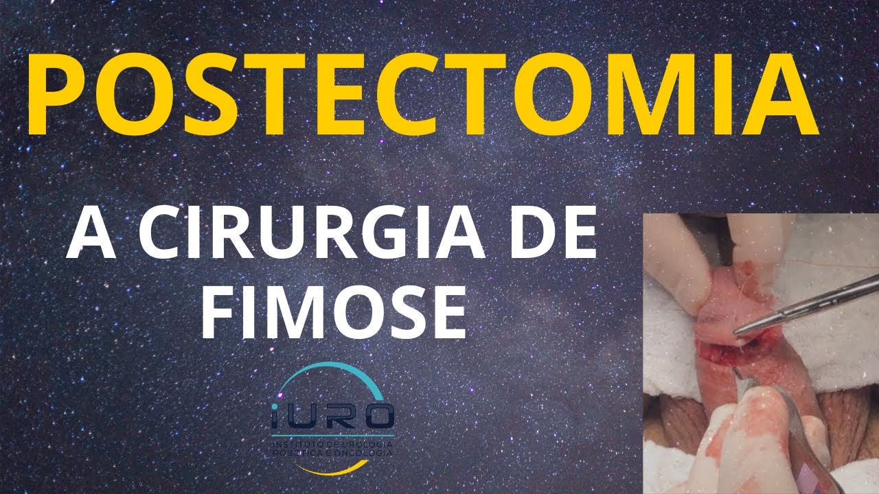 Postectomia: A cirurgia de fimose !