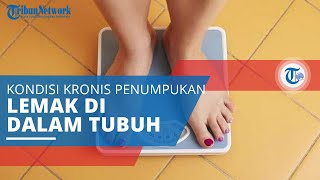 Obesitas, Kondisi Kronis akibat Penumpukan Lemak dalam Tubuh yang Sangat Tinggi