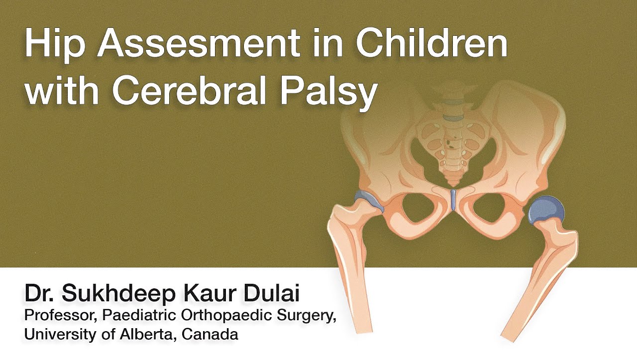 Hip Assessment in Children with Cerebral Palsy