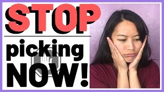 HOW TO STOP PICKING SKIN - 5 Ways to Finally Stop Popping Pimples