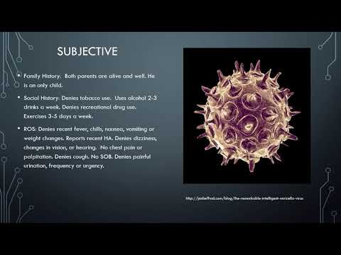 Sonya Herpes Zoster