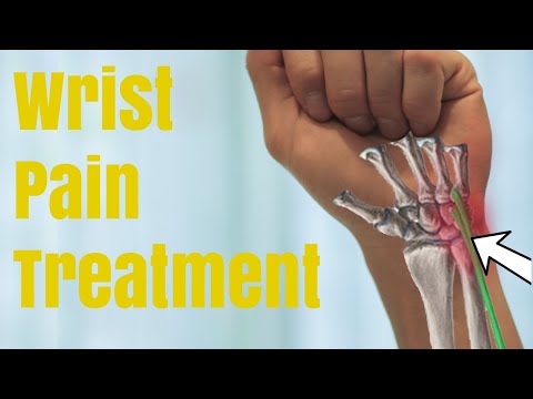 wrist pain fix in 4 minutes  | Physiotherapy