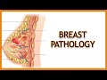 Breast Pathology Inflammatory Vs Benign Vs Malignant