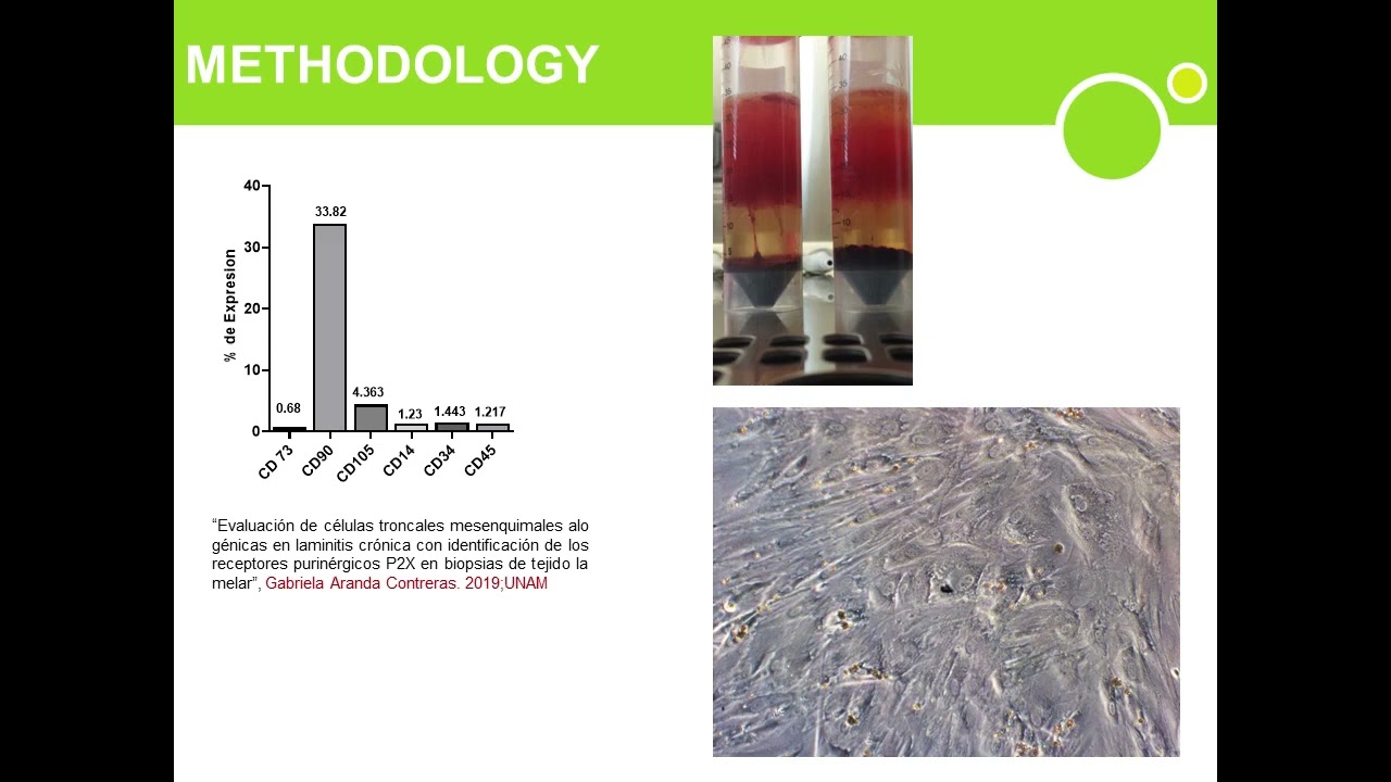 Therapeutic Effects of Allogeneic Bone Marrow Derived MSC's in Control of Pain, Inflammation