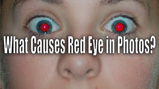 What Causes Red Eyes in Photos?