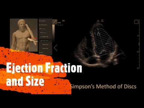 Measure  Ejection Fraction (EF) and Ventricle Size. Perioperative & Critical Care ECHO / POCUS