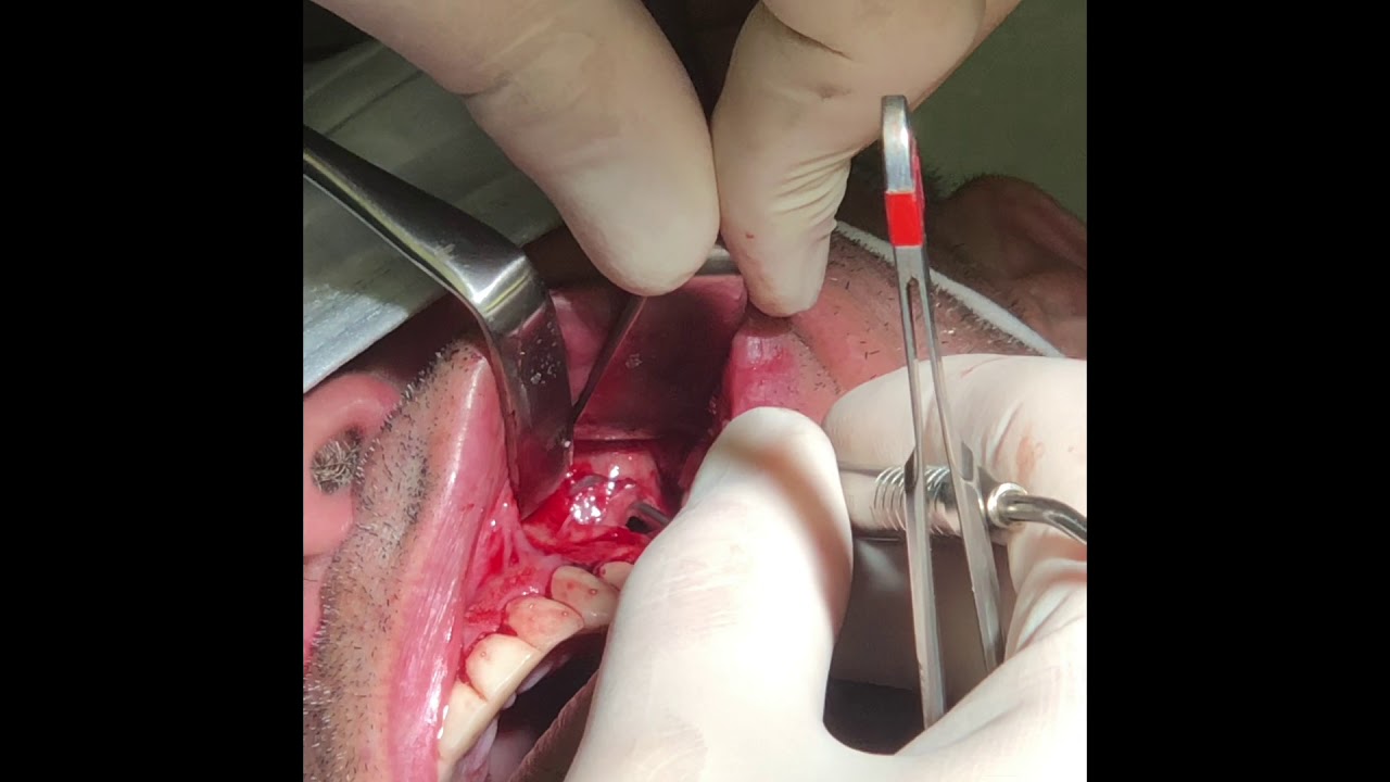 Paula Cano Carrillo-132