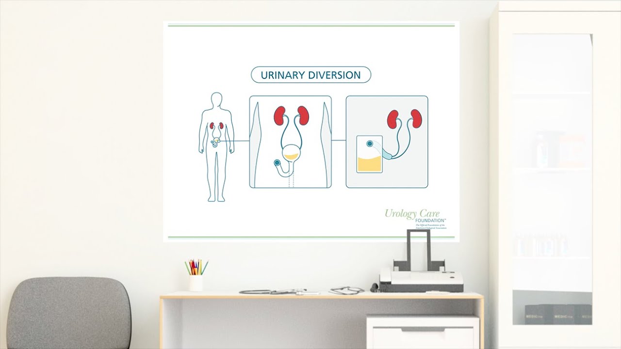 Bladder Cancer Treatment: Urinary Diversion - Urology Care Foundation