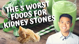 The 5 Worst Foods for Calcium Oxalate Kidney Stones | How to Prevent Getting Kidney Stones (2020)