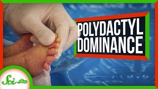 Having Six Fingers Is a Dominant Trait