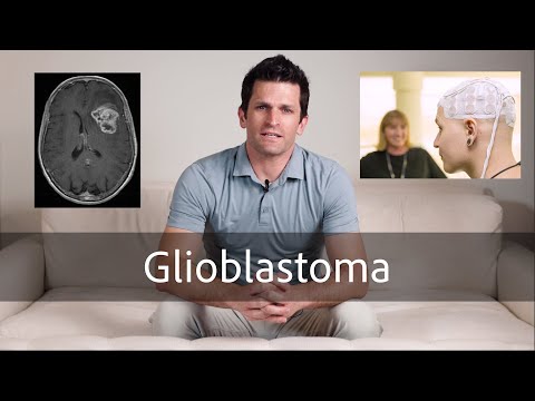 Glioblastoma // what to expect