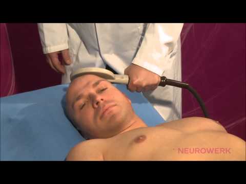 Evoked Potentials - MEP