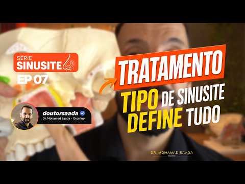 O TIPO DE SINUSITE DEFINE O TRATAMENTO: ENTENDA A DIFERENÇA