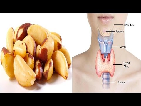 download lagu mp3 mp4 How Many Brazil Nuts A Day For Thyroid, download lagu How Many Brazil Nuts A Day For Thyroid gratis, unduh video klip How Many Brazil Nuts A Day For Thyroid
