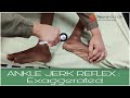 ANKLE JERK REFLEX/Test #AchillesReflex  #examination #Normal  #positive  #RootValue #observation