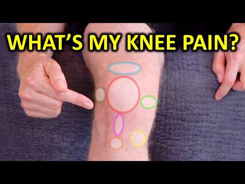 Use This Knee Pain Map to Understand Why It Hurts