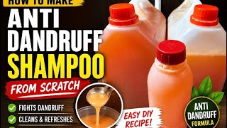How to Make Anti-Dandruff Shampoo | Step-by-Step DIY Tutorial for Beginners