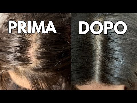 Do this BEFORE Greasy Hair Wash