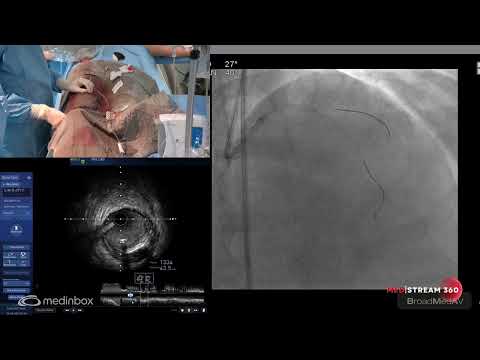 PCI To LAD Under IVUS Guidance