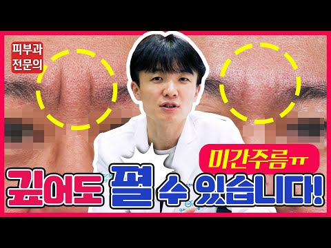 깊은 미간주름 치료하는 걸 보여달라고 하셔서 준비했습니다! 미간주름 1회차 치료 후기!