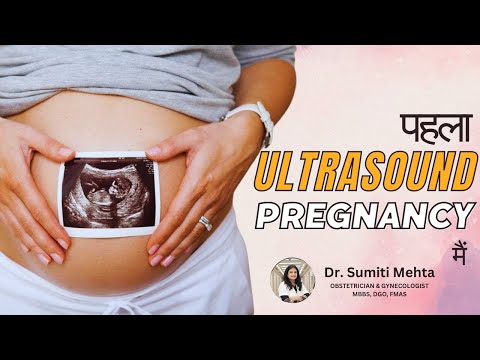 1st Ultrasound After Positive Urine Test | Positive Pregnancy Test