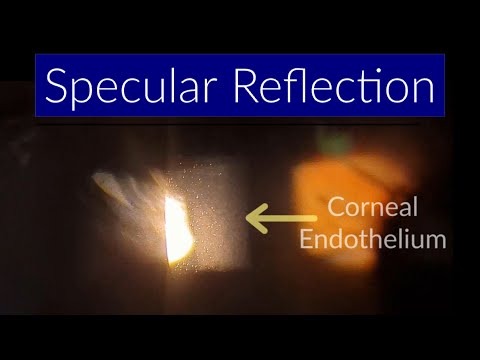 Specular Reflection - Slit Lamp Techniques