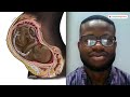 EXCLUSIVE: Why I Am Making Black Medical Drawings--Nigerian Medical Student Chidiebere Ibe