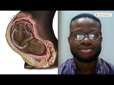 EXCLUSIVE: Why I Am Making Black Medical Drawings--Nigerian Medical Student Chidiebere Ibe