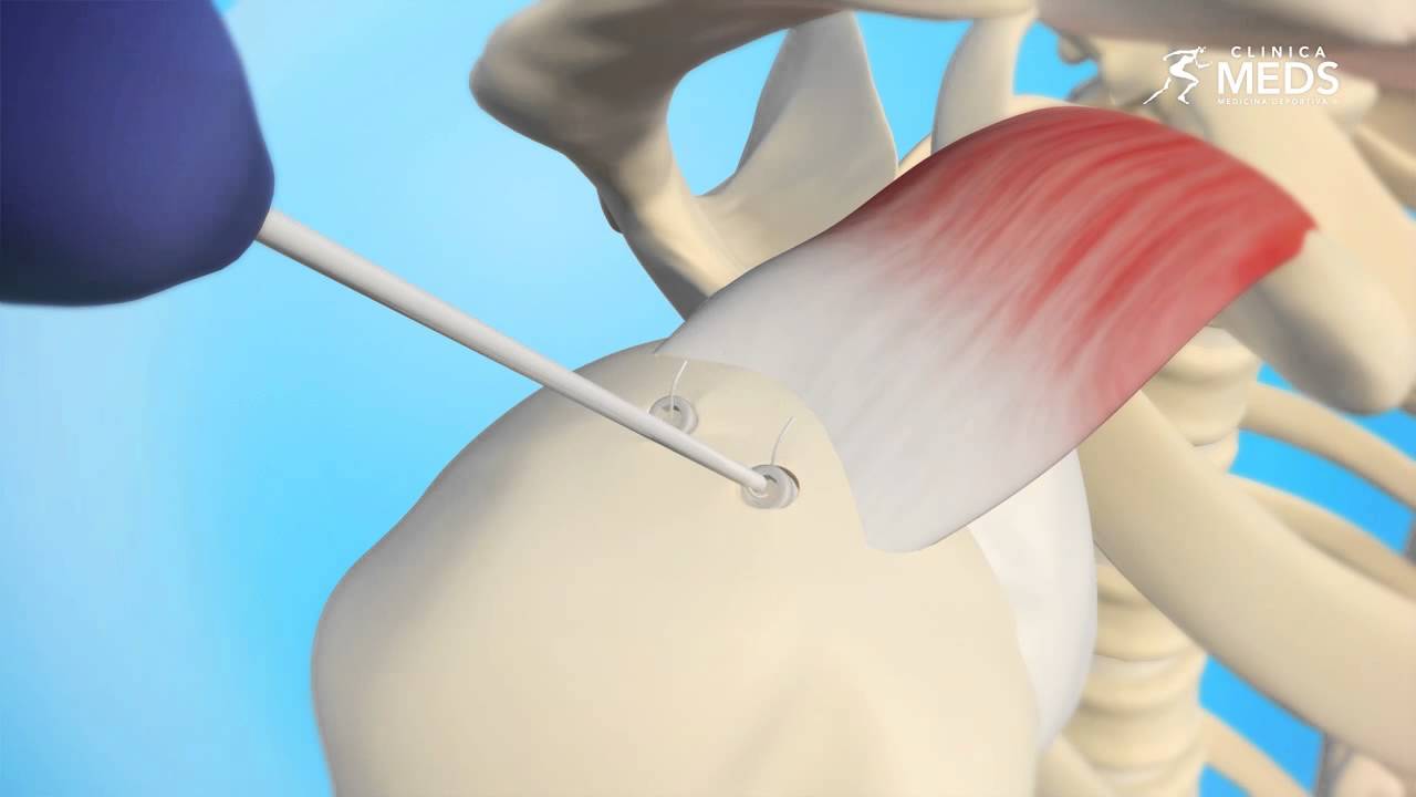 José Luis Hernández González-12