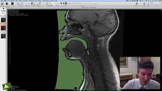 Segmentação de Via Aérea