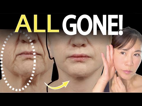 🔥Lift Cheeks Quickly and Remove Smile Lines (nasolabial fold). 🔥 Fastest Way for Results! 🤩
